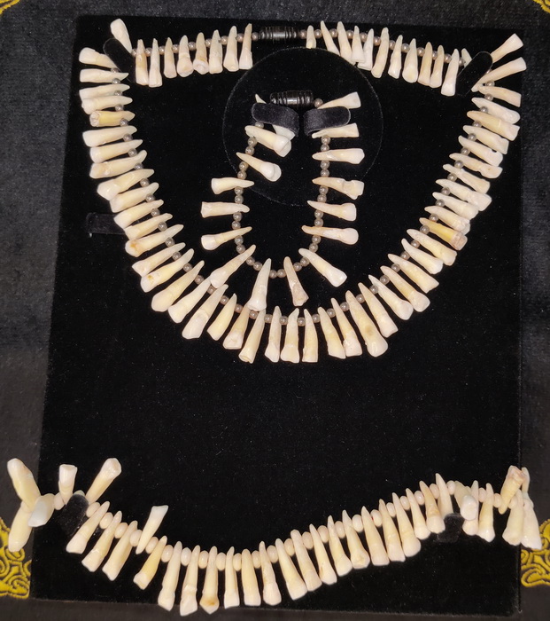 Human teeth necklace